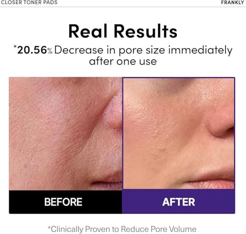 FRANKLY Pore Closer Toner Pads - Rice Jelly Pads with 9 Peptides, Vegan Collagen & Rice Extract | Pore Minimizer & Hydrating Korean Skin Care | 70 Count - görsel 4
