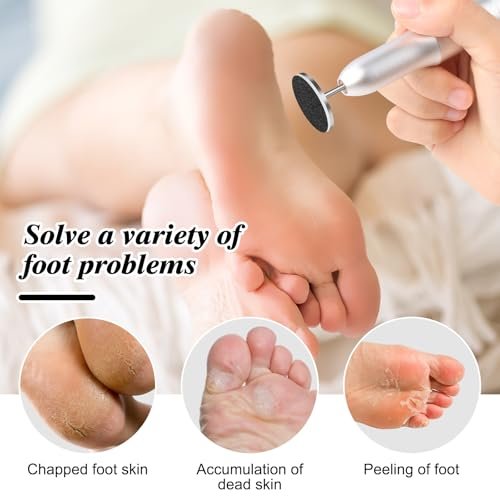 BELICOO 120 Pcs Sanding Paper Discs with 2 Metal Bits, 80/120/180/240 Grit, 25mm Round Replacement Sanding Discs for Electric Nail File, Foot Callus Remover Avelisse