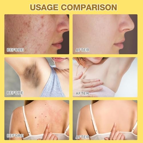 Bee Venom Treatment Cream 2026 New Professional Repair Cream for All Body Parts (2 Bottles) - Botou Face Moisturizer Avelisse
