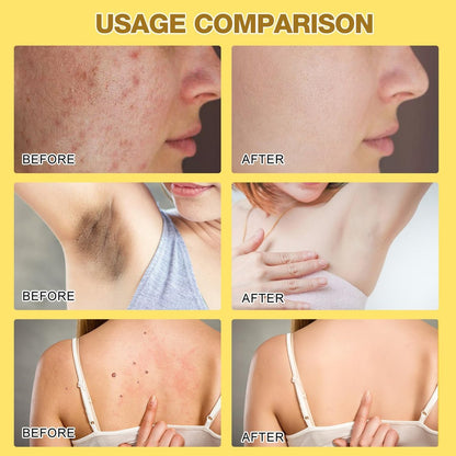 Bee Venom Treatment Cream 2026 New Professional Repair Cream for All Body Parts (2 Bottles) - Botou Face Moisturizer Avelisse
