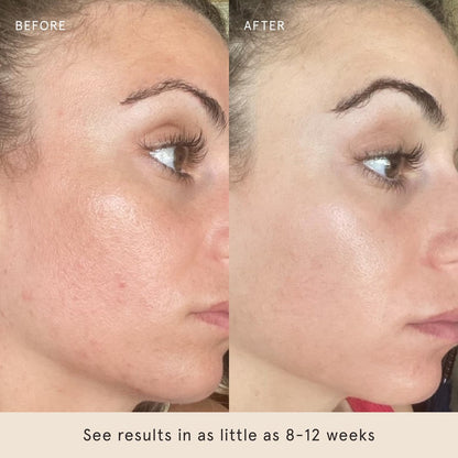 Barefaced Liquid Gold 1 Fl Oz - 15% Vitamin C Serum with Hyaluronic Acid & Vitamin E for Anti-Aging, Hydration, Antioxidant Formula, Reduces Dark Spots, Acne & Wrinkles Avelisse