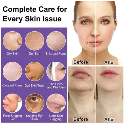 DOYEEWO 6-Piece Skin Care Set – Anti-Aging, Firming & Hydrating Facial Routine Kit for Women & Teens
