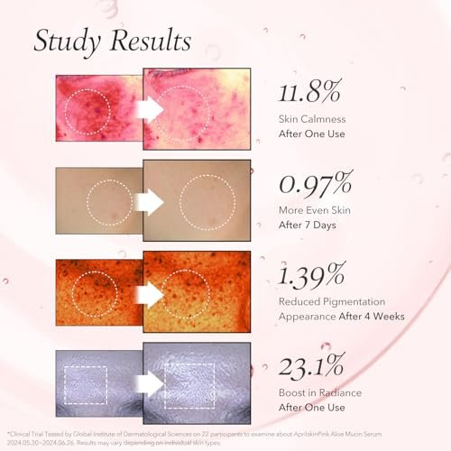 APRILSKIN Pink Aloe Mucin Serum - Hydrating 78% Jeju Aloe Formula, 1.01 fl.oz (30ml) for Glass Glow Skin Avelisse