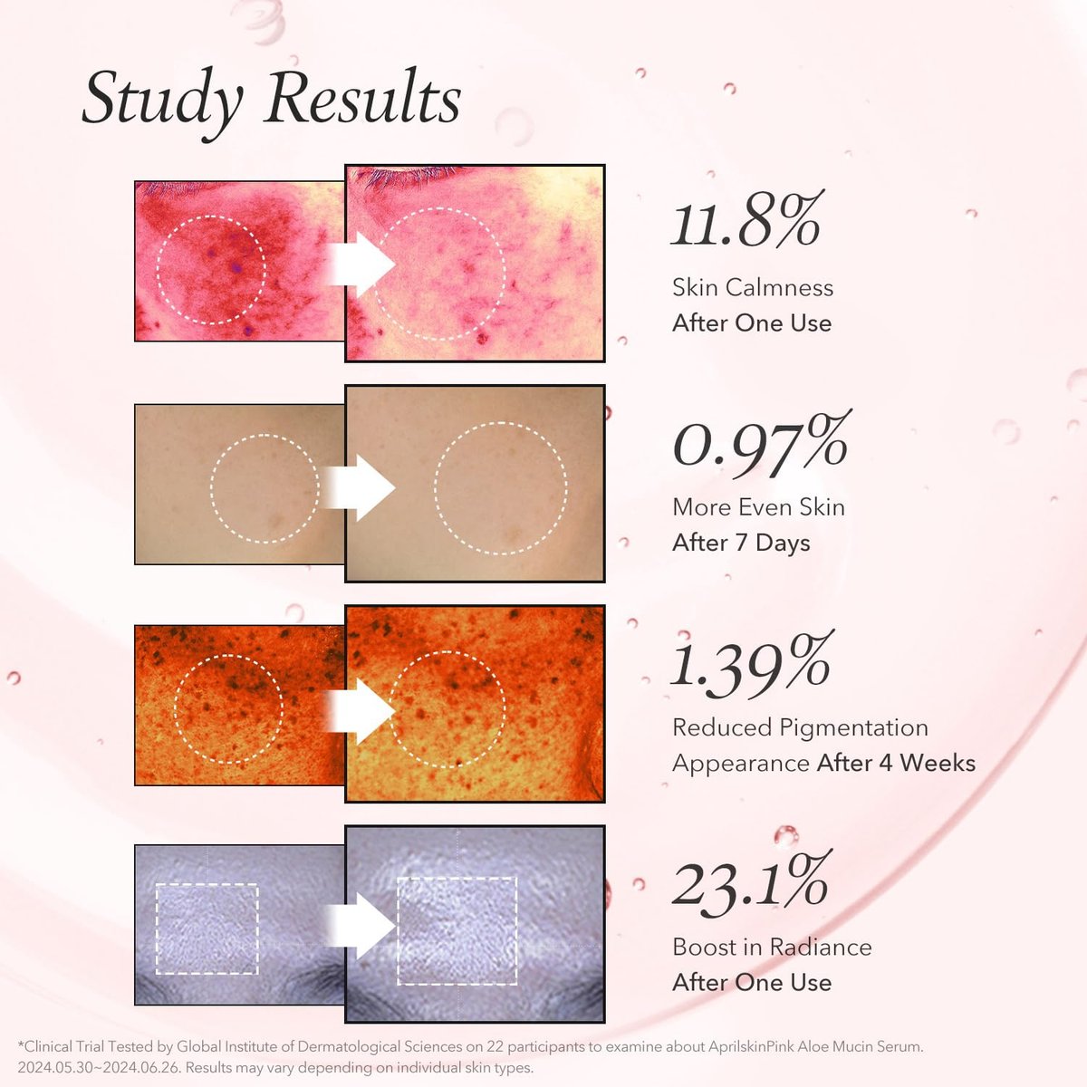 APRILSKIN Pink Aloe Mucin Serum - Hydrating 78% Jeju Aloe Formula, 1.01 fl.oz (30ml) for Glass Glow Skin Avelisse