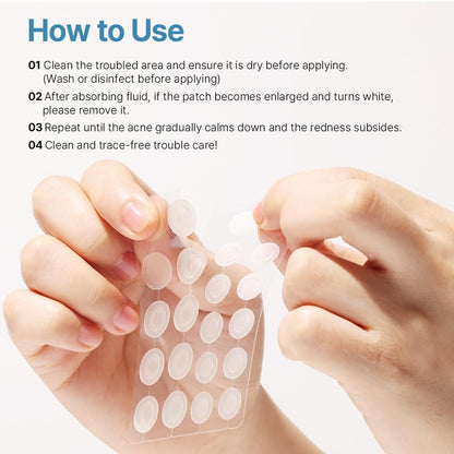Ariul True AC Clear Spot Patch – Invisible Matte Hydrocolloid Patches, Waterproof, 10mm & 12mm, Korean Skincare (110 Count) Avelisse
