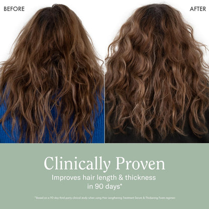 Rizos Curls Hair Lengthening Treatment Serum – Fortifies Roots for Healthy Scalp Microbiome, Promotes Longer Stronger Hair, 4.2 oz Avelisse