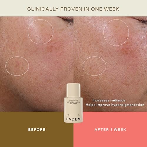EADEM Gentle Exfoliating AHA & PHA Toner - Milky Rice Toner with Lactic, Azelaic, & Tranexamic Acid - Cashmere Peel, 5.0 oz Avelisse