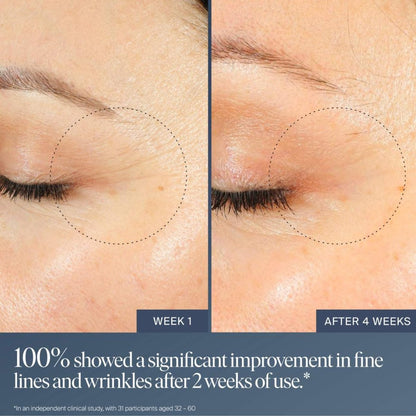 Summer Fridays Jet Lag Overnight Eye Serum - Nourishing Undereye Treatment for Dark Circles, Hydrates, Smooths, Firms & Depuffs (0.5 Fl Oz) Avelisse