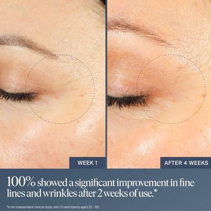 Summer Fridays Jet Lag Overnight Eye Serum - Nourishing Undereye Treatment for Dark Circles, Hydrates, Smooths, Firms & Depuffs (0.5 Fl Oz) Avelisse