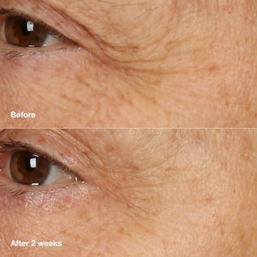 Clinique Smart Clinical Repair Anti-Aging Overnight Recovery Face Cream + Mask for All Skin Types | With Hyaluronic Acid + Peptides | Hydrating | Repairs Lines + Wrinkles, 1.7 Fl Oz Avelisse
