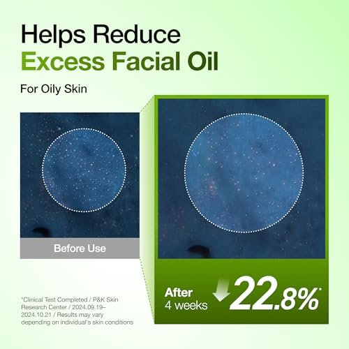 Anua Azelaic Acid 10 Hyaluron Redness Soothing Serum – Lightweight Hydrating Blemish Care for Oily & Blemish-Prone Skin, Korean Skincare, 1.01 fl oz Avelisse