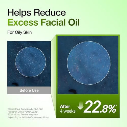 Anua Azelaic Acid 10 Hyaluron Redness Soothing Serum – Lightweight Hydrating Blemish Care for Oily & Blemish-Prone Skin, Korean Skincare, 1.01 fl oz Avelisse