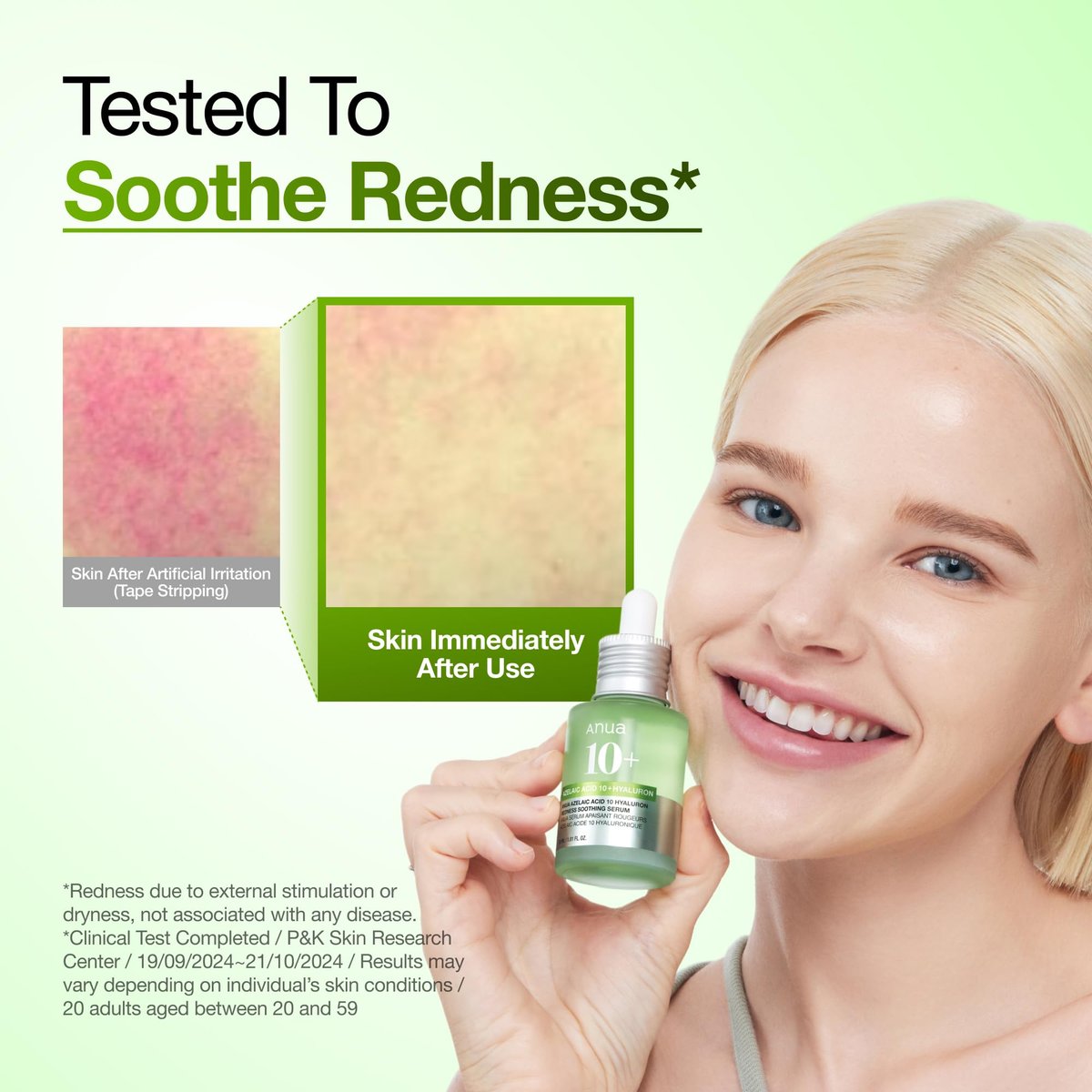 Anua Azelaic Acid 10 Hyaluron Redness Soothing Serum – Lightweight Hydrating Blemish Care for Oily & Blemish-Prone Skin, Korean Skincare, 1.01 fl oz Avelisse