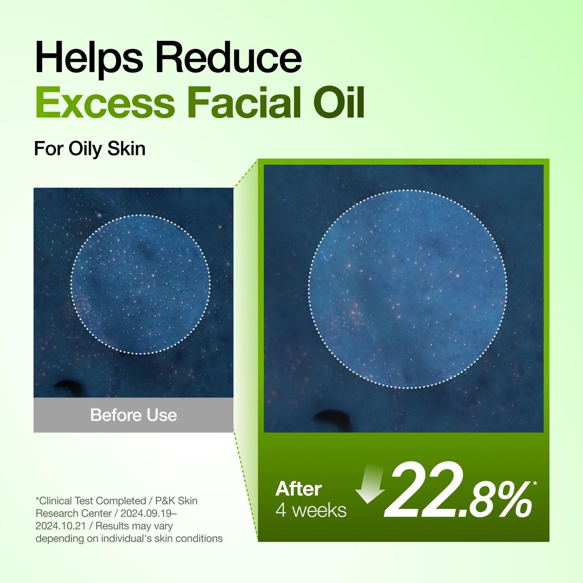 Anua Azelaic Acid 10 Hyaluron Redness Soothing Serum – Lightweight Hydrating Blemish Care for Oily & Blemish-Prone Skin, Korean Skincare, 1.01 fl oz Avelisse