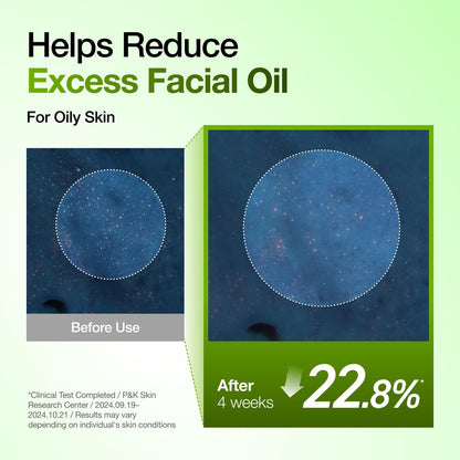 Anua Azelaic Acid 10 Hyaluron Redness Soothing Serum – Lightweight Hydrating Blemish Care for Oily & Blemish-Prone Skin, Korean Skincare, 1.01 fl oz Avelisse