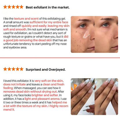 QUARXERY Purifying Exfoliating Gel 2-Pack: Gentle Facial Peeling Gel Scrub for Cleansing Dirt & Oils Avelisse