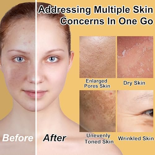 Lifting & Firming Anti-Aging Skin Care Set Kit for Women & Teens - Niacinamide Retinol Serum, Hyaluronic Acid Serum, Travel Size Skincare Gift Set - görsel 4