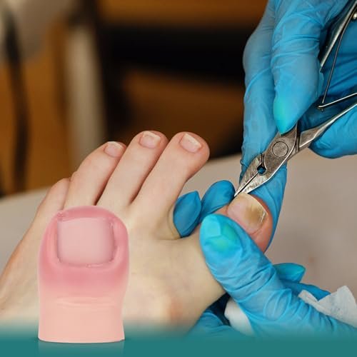 MedEduQuest Ingrown Toenail Trainer - Realistic Wound Care Training Model for Medical Education - görsel 12