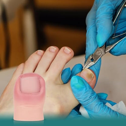 MedEduQuest Ingrown Toenail Trainer - Realistic Wound Care Training Model for Medical Education