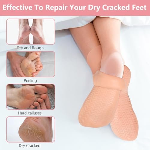 Silicone Moisturizing Socks for Dry Cracked Feet - 2 Pairs, XL Long Size, Non-Slip Heel Socks for Women and Men - High Stretch Foot Care Pedicure - White & Beige Avelisse