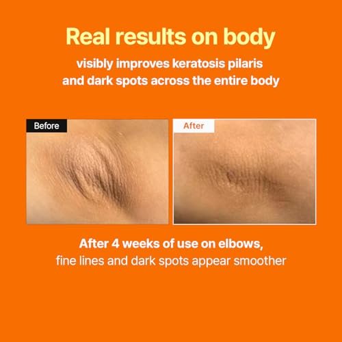 MEDITHERAPY Retinal Skin Booster Serum – Retinaldehyde & Niacinamide Anti-Aging Serum for Fine Lines, Firming & Radiance, Hydrating Face Serum for All Skin Types, 5.07 fl oz Avelisse