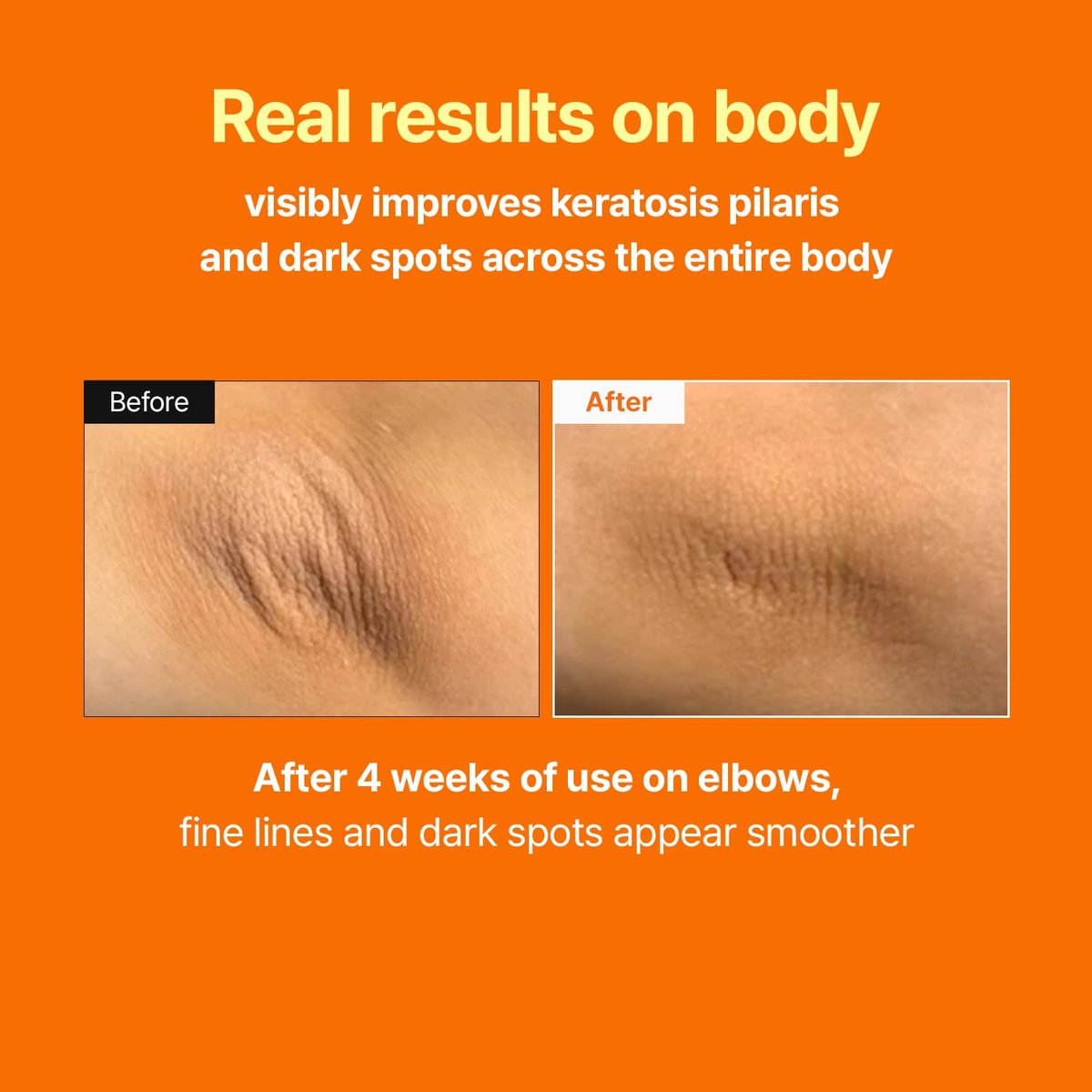 MEDITHERAPY Retinal Skin Booster Serum – Retinaldehyde & Niacinamide Anti-Aging Serum for Fine Lines, Firming & Radiance, Hydrating Face Serum for All Skin Types, 5.07 fl oz Avelisse