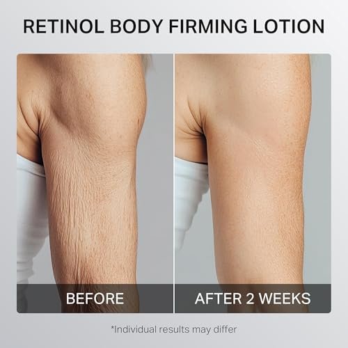 Depology Ultra-Size Firming Retinol Body Lotion for Crepey Skin & Keratosis Pilaris - Anti-Aging Moisturizer with 0.05% Retinol, AHA & Collagen, 10.14 fl oz Avelisse