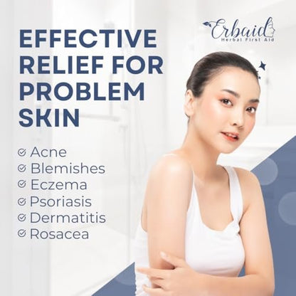 Erbaid Pyrithione Zinc Soap Bar for Face & Body – 4oz, 2% ZnP Cleanser for Acne, Rosacea, Eczema, Dermatitis, Psoriasis & Itching – Calming Zinc Facial Wash, Made in USA