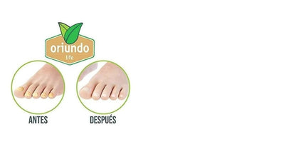 Oriundo Natural Life Nail Treatment Solution – 9 Natural Ingredients, 3-Month Supply for Stronger, Healthier Nails Avelisse