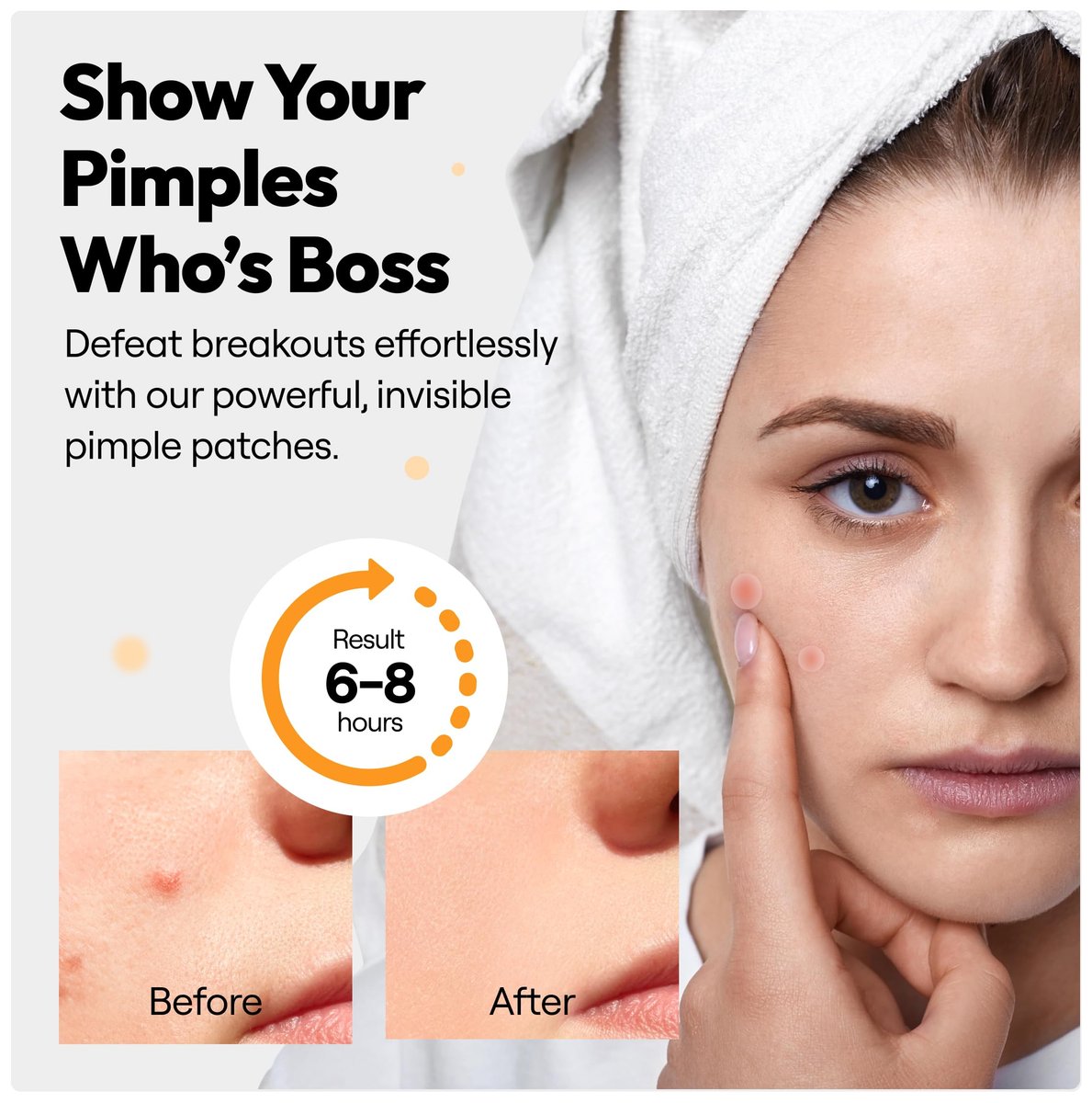 300 Pimple Patches – Hydrocolloid Zit Stickers with Salicylic Acid, Tea Tree & Calendula | Overnight Blemish Care - görsel 9