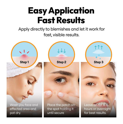 300 Pimple Patches – Hydrocolloid Zit Stickers with Salicylic Acid, Tea Tree & Calendula | Overnight Blemish Care