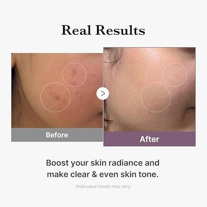 medicube Age-R Glutathione Glow Milky Toner - Low-Irritation Double Layer Toner for Glass Glow Skin with Peptide, Even Skin Tone, Radiance, Hydration, Korean Skincare (4.73 Fl Oz)