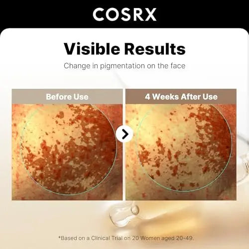 COSRX 2% Alpha Arbutin Discoloration Care Face Serum with Niacinamide, Glutathione & Tranexamic Acid - Dark Spot & Uneven Tone Corrector, Daily Korean Skincare for Men and Women, 1.7 fl oz Avelisse