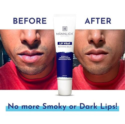 Mannlich Lip Balm for Men with SPF 50 PA++++ & 2% Kojic Acid – Moisturizing Lip Care for Dry & Chapped Lips, 10g