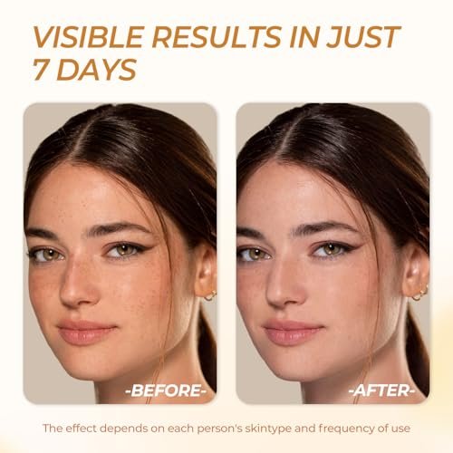 FIUMOT Deep Vitamin C Golden Capsule Hydrating Face Moisturizer - Antioxidant Protection, Lightweight Daily Skincare Avelisse