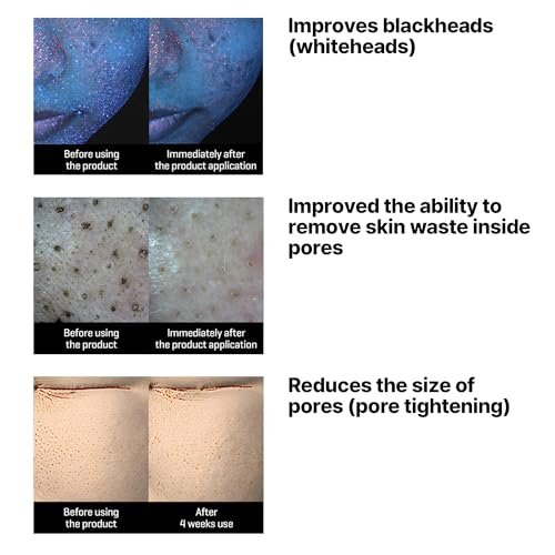 SOME BY MI Lacto Soy Sebum & Blackhead Cleansing Oil – 6.76oz (200ml) – Korean Vegan Makeup-Removing Oil Cleanser with Soybean Extract & Serine – Deep Cleansing for Blackheads & Pores - görsel 10