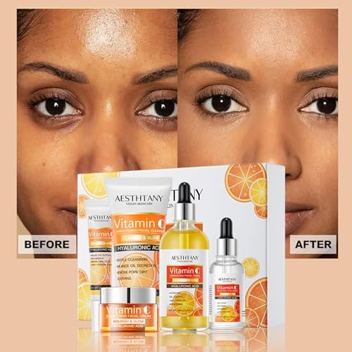 R RadiantRise Vitamin C Skin Care Set For Women – 5-In-1 Moisturizing Hyaluronic Acid Skincare Routine with Facial Cleanser, Serum, Face Cream, Eye Cream, Toner Avelisse