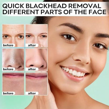 Blackhead Remover Peel Off Mask for Nose & Face - 100 Strips + 1.7oz Pore Cleansing Kit Avelisse