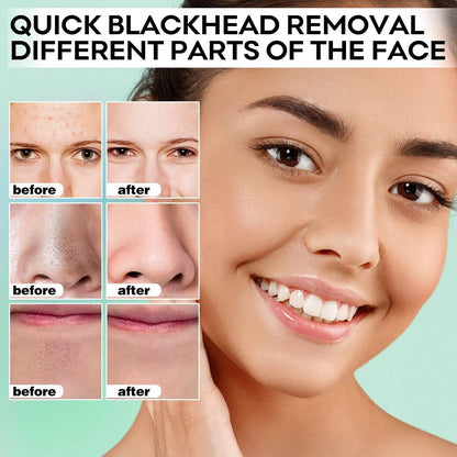 Blackhead Remover Peel Off Mask for Nose & Face - 100 Strips + 1.7oz Pore Cleansing Kit Avelisse