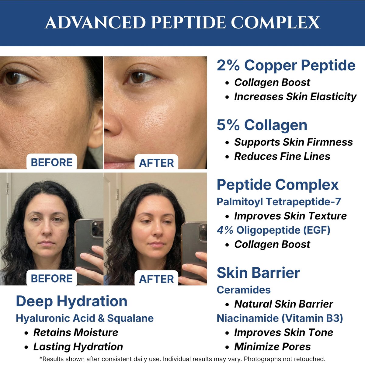 Copper Peptides Serum for Face with 2% Copper Peptide, 4% EGF, Niacinamide, Ceramides, Squalane & Hyaluronic Acid - Multi Peptide Anti-Aging Serum, 1 fl oz Avelisse