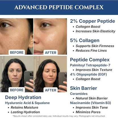 Copper Peptides Serum for Face with 2% Copper Peptide, 4% EGF, Niacinamide, Ceramides, Squalane & Hyaluronic Acid - Multi Peptide Anti-Aging Serum, 1 fl oz Avelisse