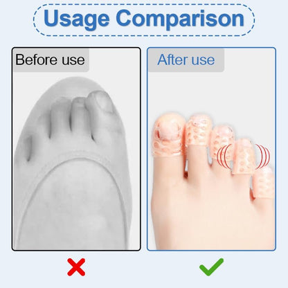 Cukux 20-Pack Silicone Toe Protectors - Anti-Friction, Breathable Toe Separators for Corns, Blisters, and Pain Relief - Clear Pinky Toe Sleeves for Women and Men