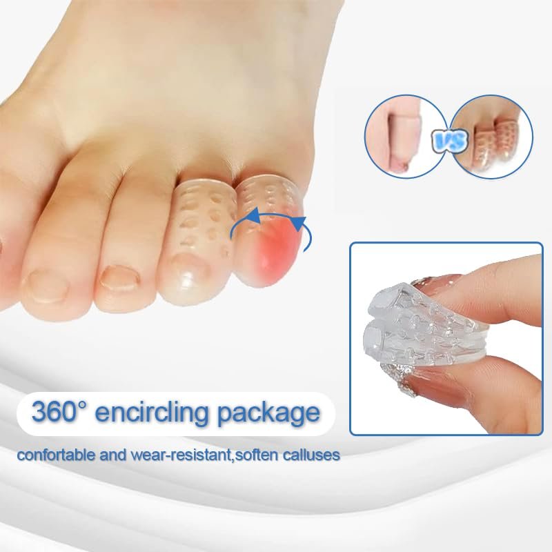Cukux 20-Pack Silicone Toe Protectors - Anti-Friction, Breathable Toe Separators for Corns, Blisters, and Pain Relief - Clear Pinky Toe Sleeves for Women and Men - görsel 4