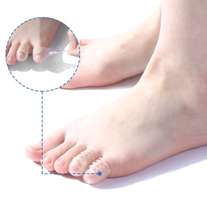 Cukux 20-Pack Silicone Toe Protectors - Anti-Friction, Breathable Toe Separators for Corns, Blisters, and Pain Relief - Clear Pinky Toe Sleeves for Women and Men - görsel 3
