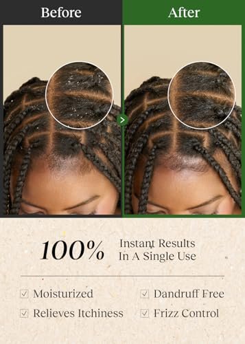Bephor Scalp Cleansing Toner with Apple Cider Vinegar for Braiding Hair - No-Rinse Moisturizing Scalp Exfoliator, 6.76 Fl Oz Avelisse