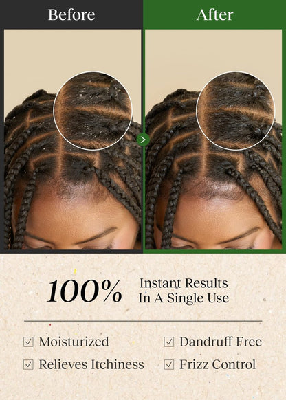 Bephor Scalp Cleansing Toner with Apple Cider Vinegar for Braiding Hair - No-Rinse Moisturizing Scalp Exfoliator, 6.76 Fl Oz Avelisse