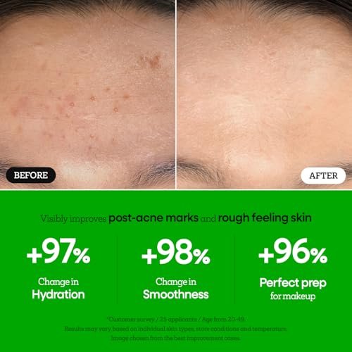 Nature Republic The First Peptide Boosting Serum – Niacinamide, Adenosine, Hydrating & Firming Facial Serum for Fine Lines & Pores, Korean Skincare, 150ml / 5.07 fl oz Avelisse