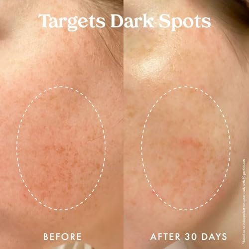 Kopari Star Bright Vitamin C Moisturizer with Starfruit & Niacinamide - Lightweight Brightening Face Moisturizer, 1.7 oz Avelisse