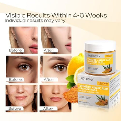 Turmeric Kojic Acid Cleansing Pads - 50 PCS Exfoliating Face Wipes for Balanced Skin Oil