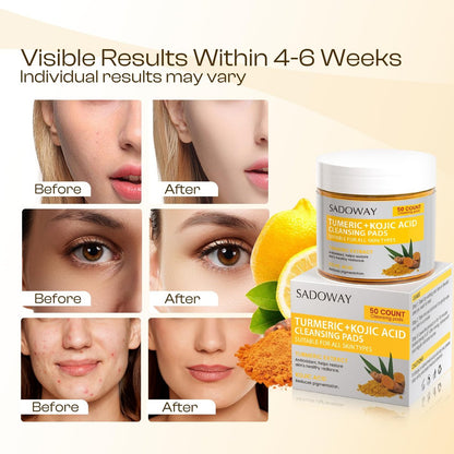 Turmeric Kojic Acid Cleansing Pads - 50 PCS Exfoliating Face Wipes for Balanced Skin Oil
